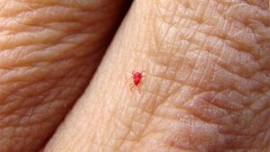 A closeup of a chigger on a person's finger