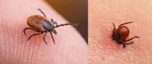 Left: a tick on a person's finger. Right: A tick embedded in skin.